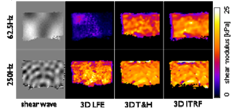ismrm2009_thumbnail.png