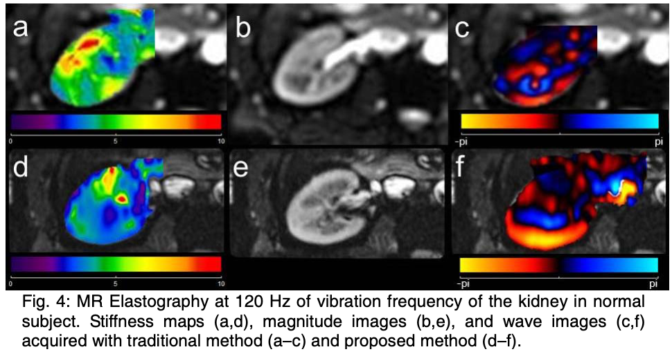 ismrm2014_thumbnail.png